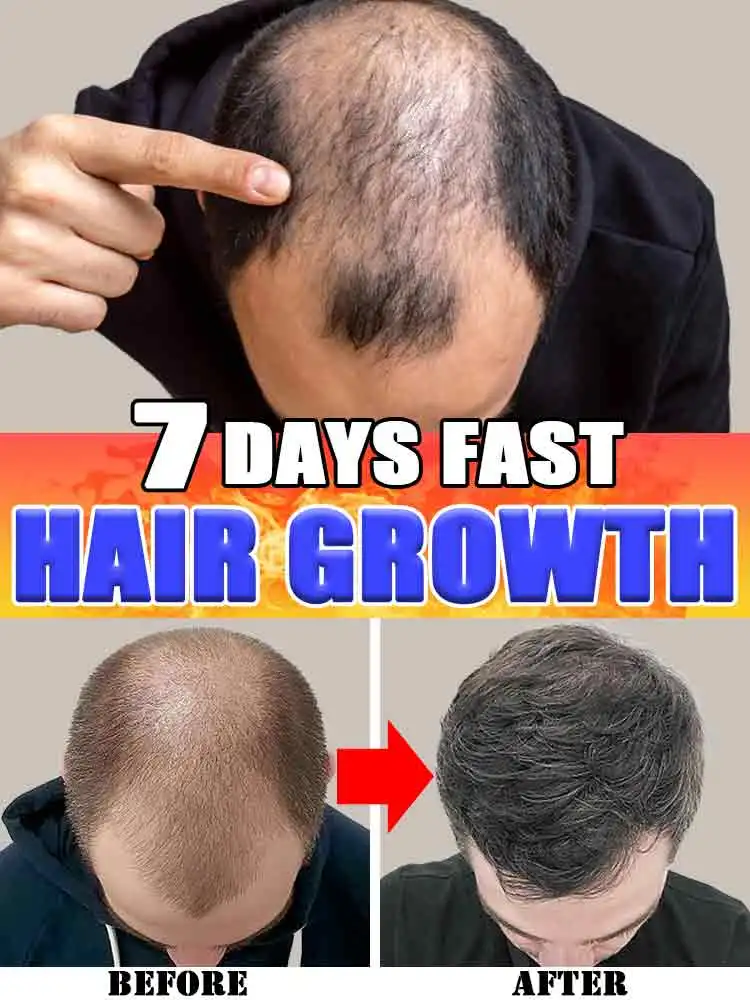 

Rapid Hair Growth Conditioning Serum Treat Hairline Repair Damaged Hair Prevent Hair Loss Grow Hair Rapidly