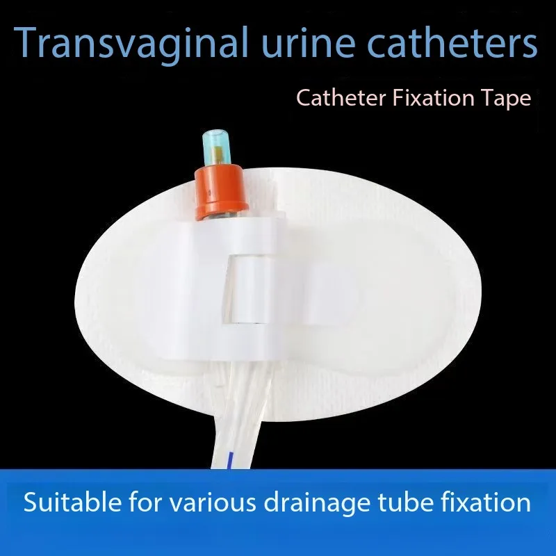 

Клей для фиксации труб, универсальный клей для фиксации труб, двойной люмен, пластырь для фиксации дренажных труб