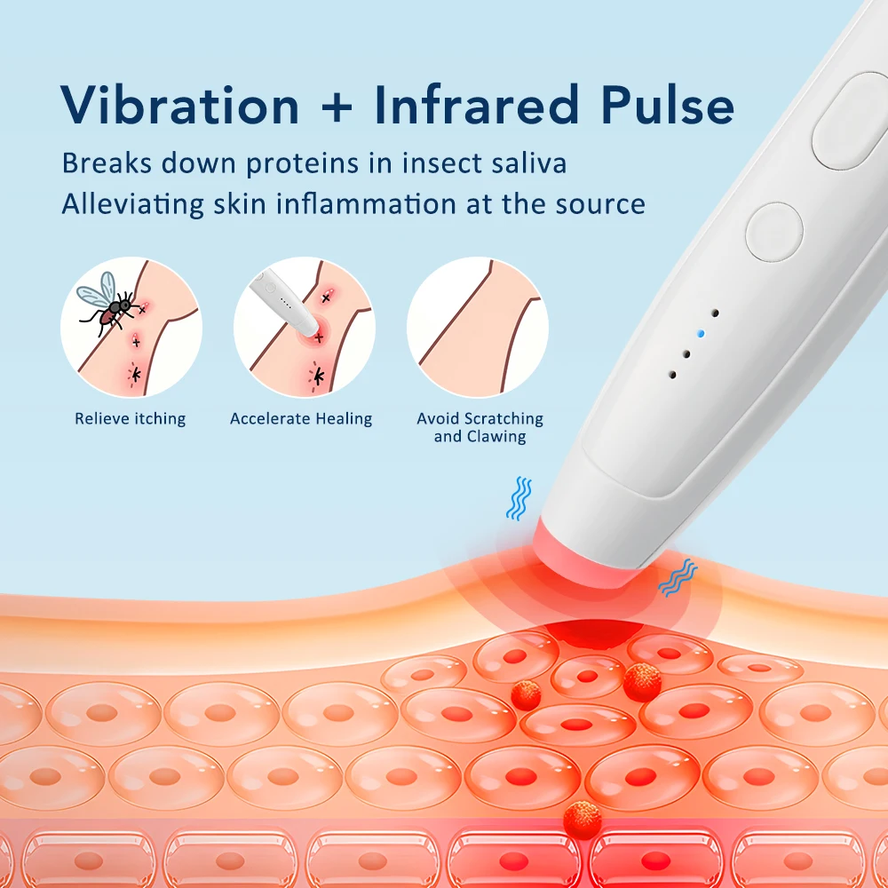 

Портативная импульсная ручка для облегчения зуда комаров, укусов насекомых, натуральная ручка для облегчения зуда от насекомых, ручка против зуда для взрослых и детей