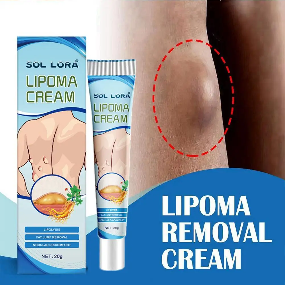 Lipoma Removal Cream Lipolysis Fat Lump Relief Plaster Skin Swelling Fat Elimination Cream Drop Shipping 20g Health Care