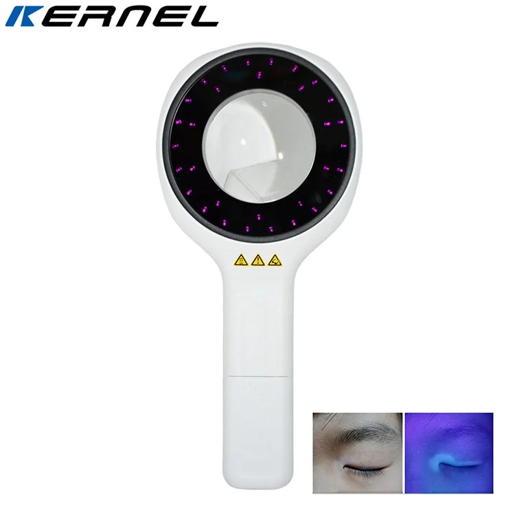 Kernel KN-9000C Cheap Price Wood's Lamp Wood's Light for Veterinary medicine applications