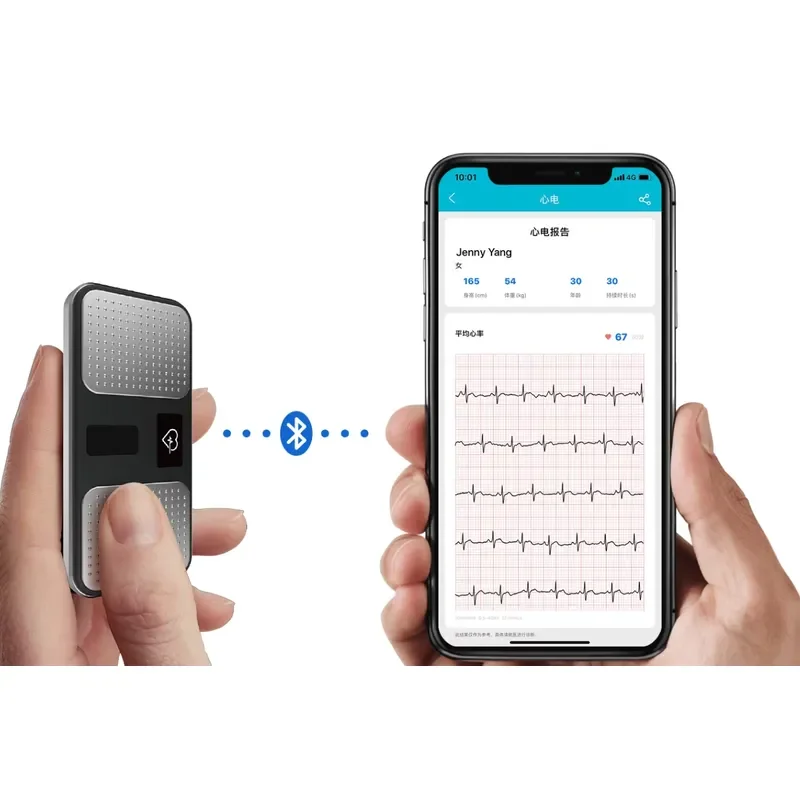 Modern Medical KardiaMobile 6L Handheld Personal Single Lead Device for Heart Rhythm Tracking Compatible with