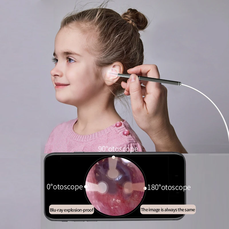 Smart Ear Cleaner Endoscope Spoon Camera Ear Picker Cleaning Wax Removal Visual Earpick Wifi Mouth Nose Otoscope Support Android