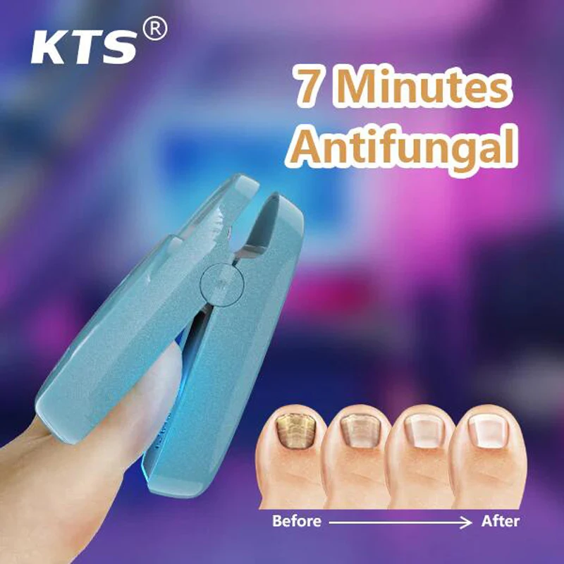 Nail Laser Fungus Device 7 Minutes Painless Nail Treatments Device Toenails Onychomycosis Cure Machine 905nm LLLT Blue Color