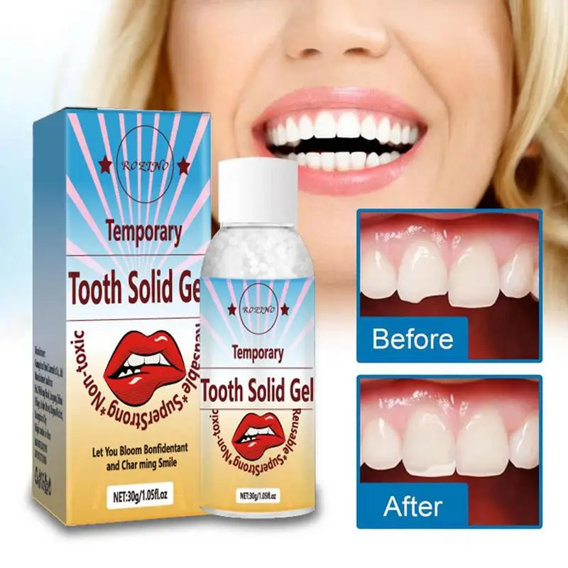 Tooth Repair Beads Reusable Super Strong Tooth Gap Filler 30g Thermal Fitting Beads Teeth Veneers Chipped Tooth Repair Kit