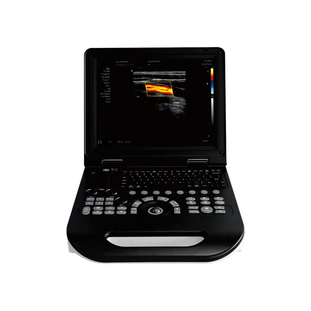 Hospital Medical 15 Inch LCD Portable Color Doppler Ultrasound Scanner