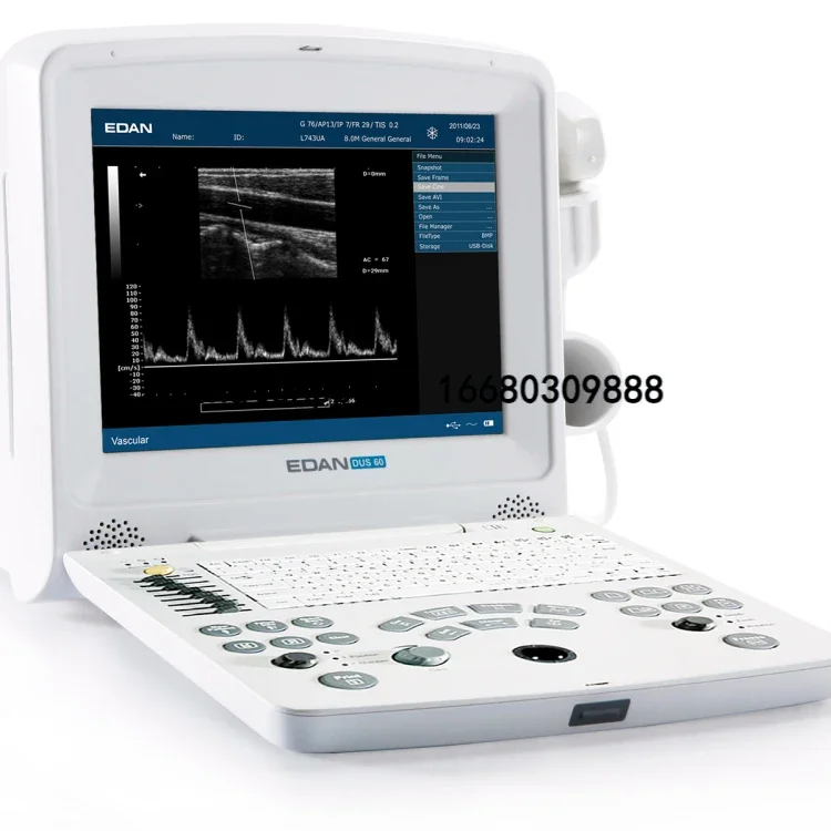 Stock ! ! !  Veterinary portable ultrasound edan ultrasound machine dus 60 dus60