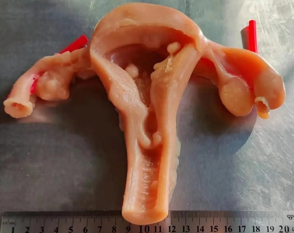 Silicone Uterus Model for Gynecological Laparoscopic Training Shearing Suture Practice