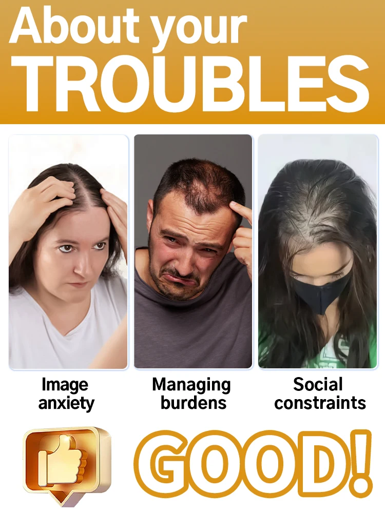 Generation-2,M-shaped,ᴀɴᴛɪ-ʜᴀɪʀ ʟᴏꜱꜱ Solving scalp problems