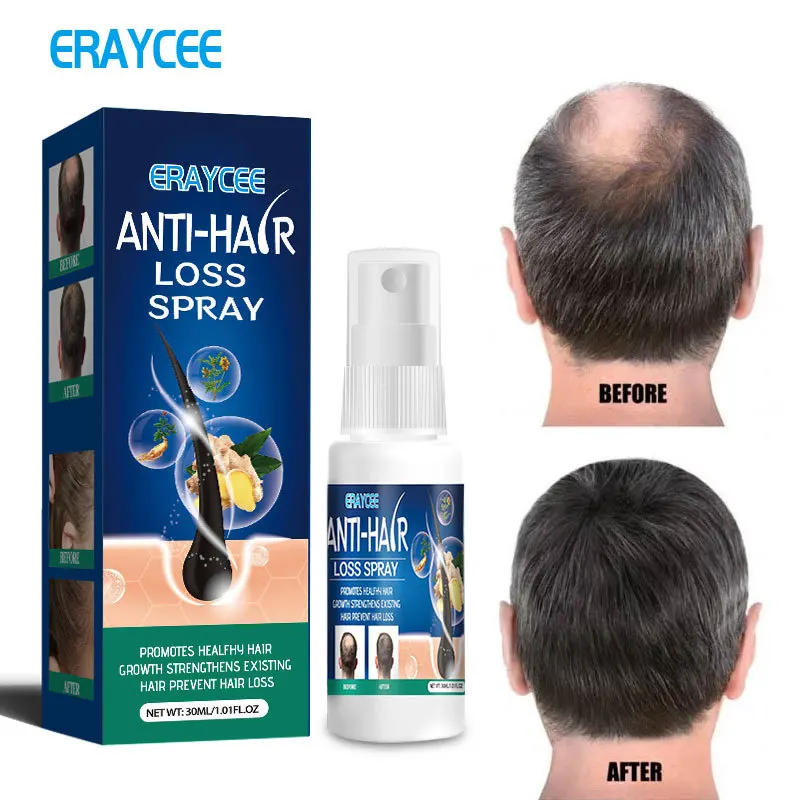 

ERAYCEE Ginger Hair Growth Spray Products Natural Anti Hair Loss Serum Prevent Baldness Treatment Fast Grows Nourish Damaged Hai