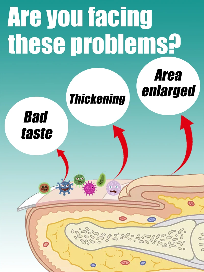 يغير الحياة وقلم ليزر للأظافر بلون الشمبانيا s sṁs