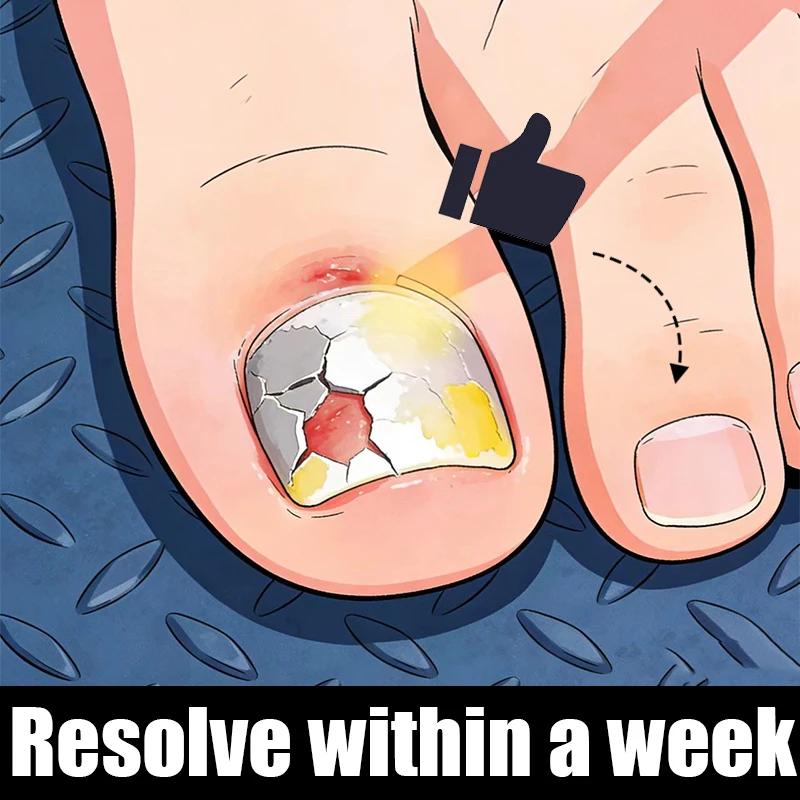 

Having nail cleaning and care tools can give you beautiful nails