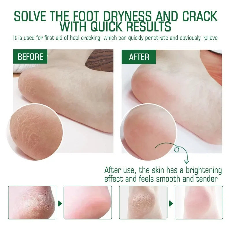 Sdotter New Cracked heel care cream Repair peeling Anti-drying Crack foot moisturizing Removal Calluses Bad Skin Hand feet care