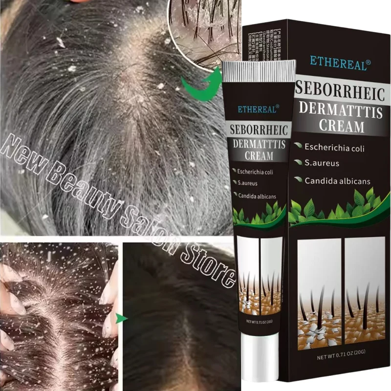 

Быстрый отшелушивающий крем для удаления перхоти, средство против зуда, средство для борьбы с себорейным маслом для кожи головы, очищает, восстанавливает уход за кожей головы