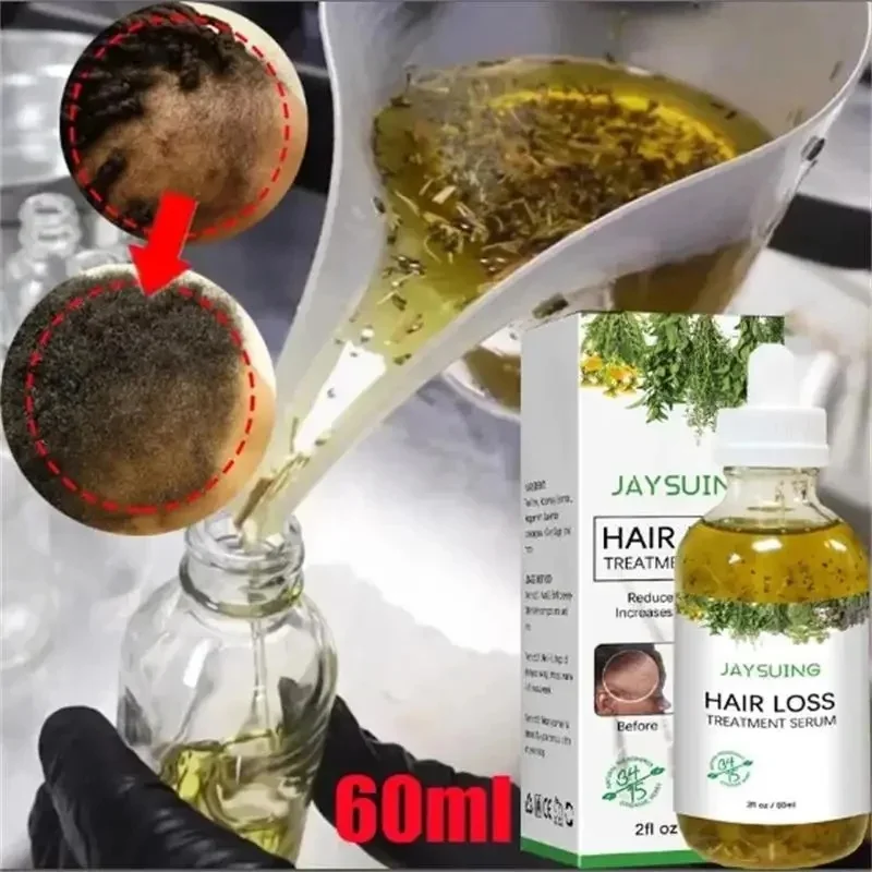 

Rosemary Essentiall Oil Hair Growth Products Organic Hair Products Scalp Hair Strengthening Oil For Nourish Shiny Hair Healthy