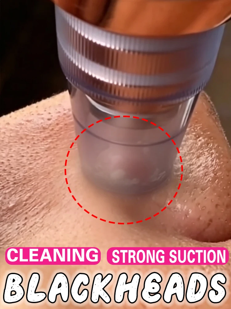 blackhead-mask-vacuum-cleaner-blackhead-removal-skin-3-suction-mode-face-cleansing-beauty-machine-dead-remover-face-vacuum