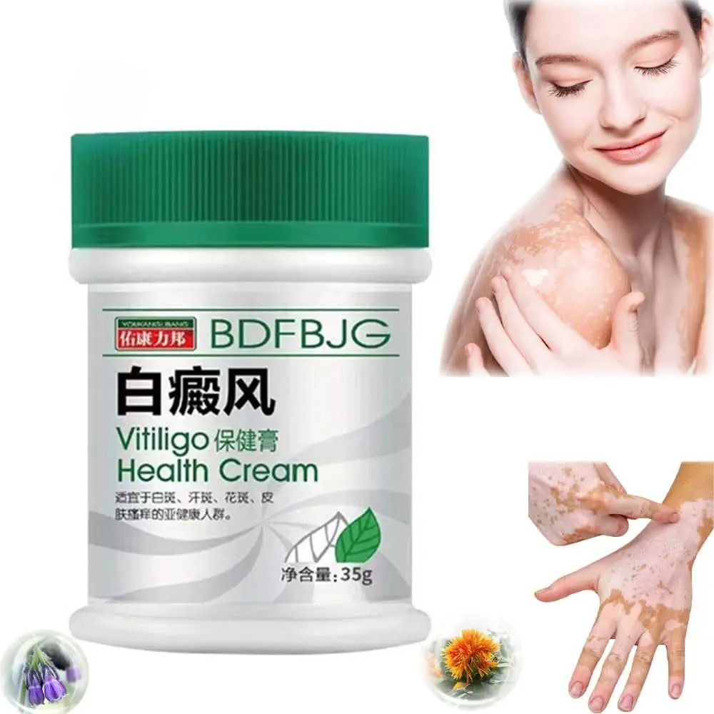 Natural TreatVitiligo Soothing Cream Improve Skin Discoloration Skin Care Vitiligo Care Cream Fast Soothing Fast Penetration