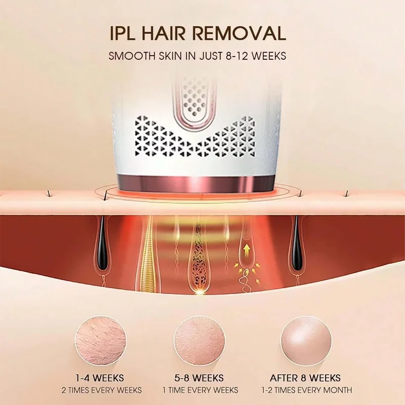 Bestverkocht huishoudelijk IPL laser ontharingsapparaat Draagbaar en krachtig laser ontharingsapparaat Huidverzorgingshulpmiddel voor dames