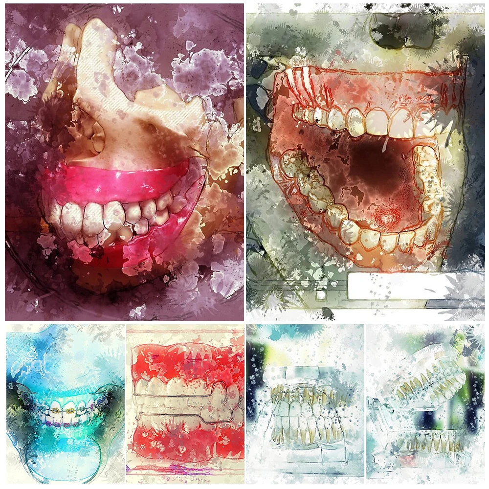 Orthodontics Dentistry Dentist Teeth Tooth Poster Wall Art Canvas Painting Home Decor Wall Pictures For Living Room Unframed