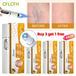 4Pcs Varicose Veins Laser Therapy Pen Improves Blood Circulation For Men Women Relieve Leg Pain Improve Moderate Varicose Vein