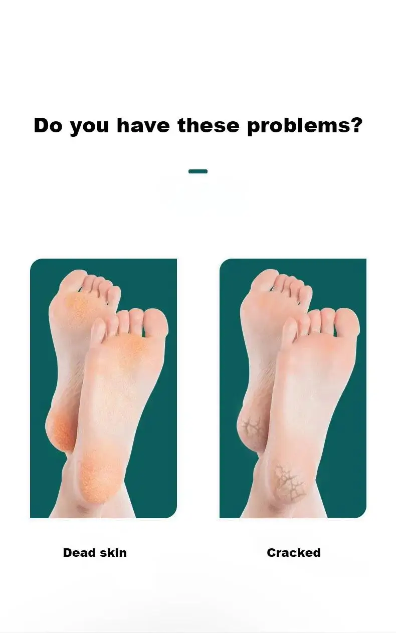 Lima per piedi a doppia faccia Strumenti per la cura del piede per pedicure Rimozione del callo della pelle morta Acciaio inossidabile professionale