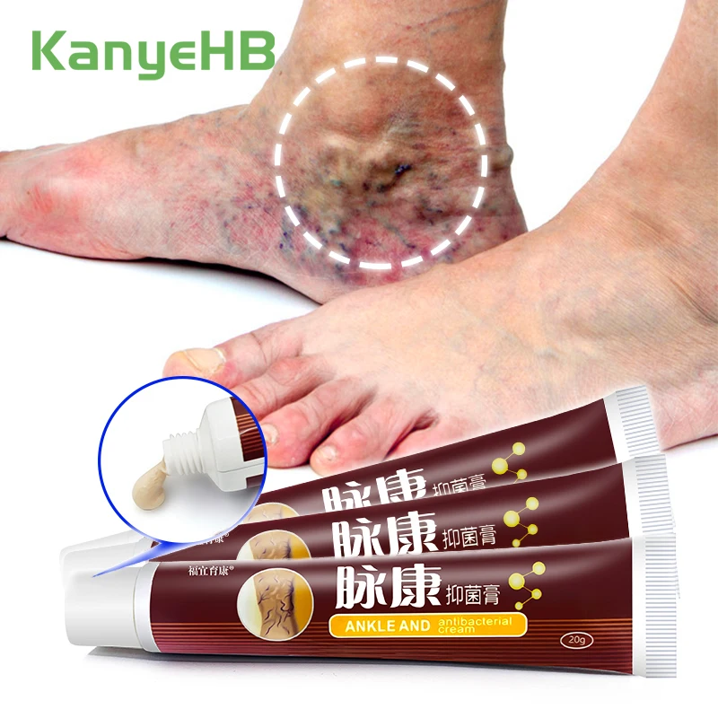 

3pcs Varicose Vein Treatment Cream Relieve Vein Pain Swelling Privates Varicocele Herbal Varicosity Ointment Leg Varices A429