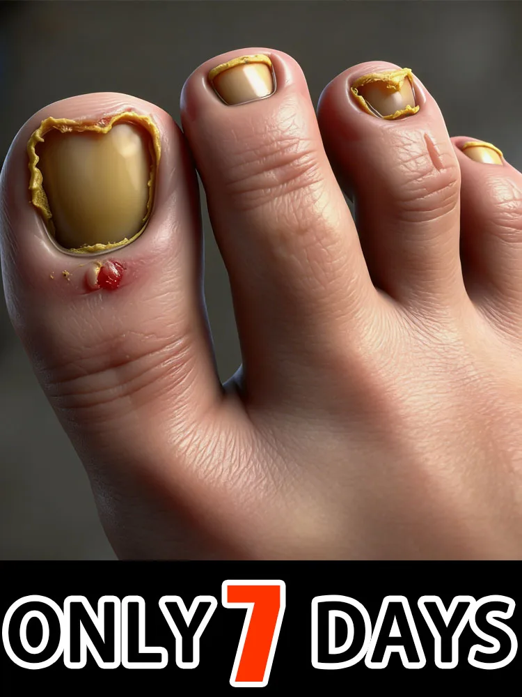 

Новое поколение 2 в 1, омоложение — технология предотвращения грибка — регулируемый датчик управления и безопасности