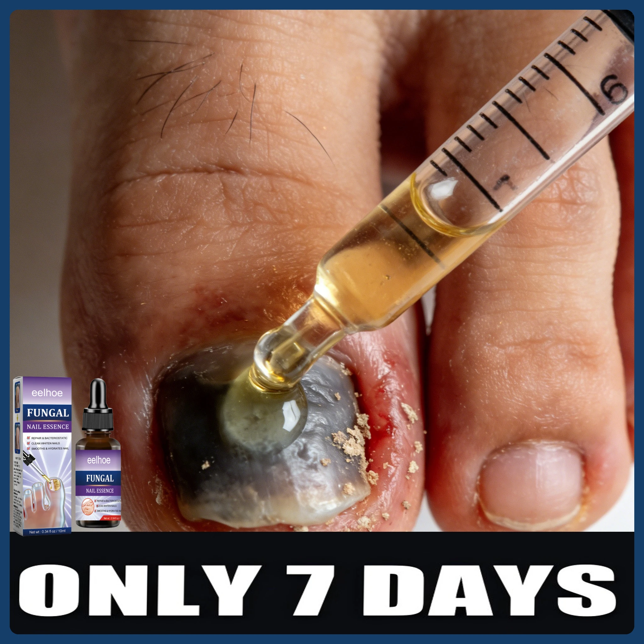 HT Rejuvenator - Fungus Prevention Technology - Adjustable Temperature Control & Safety Sensor