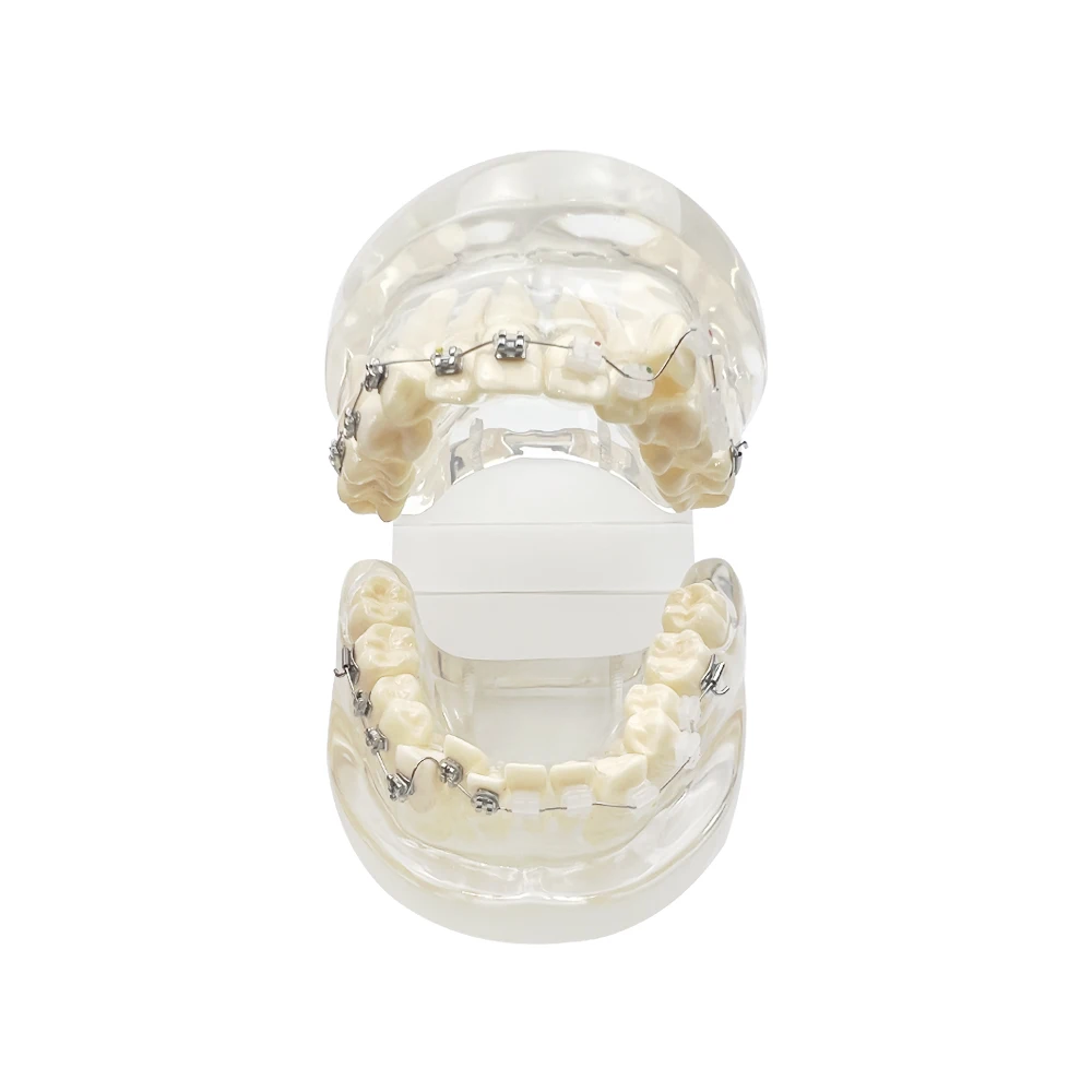 Dental Transparent Teaching Model Orthodontic Teeth Model With Metal Wires and Bracket for Patient Communication Studying Demo