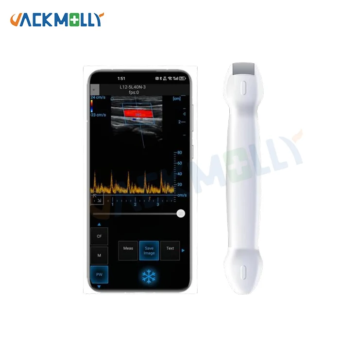 JM-D7 ultrasound color doppler ultrasound probe wireless ultrasound equipment