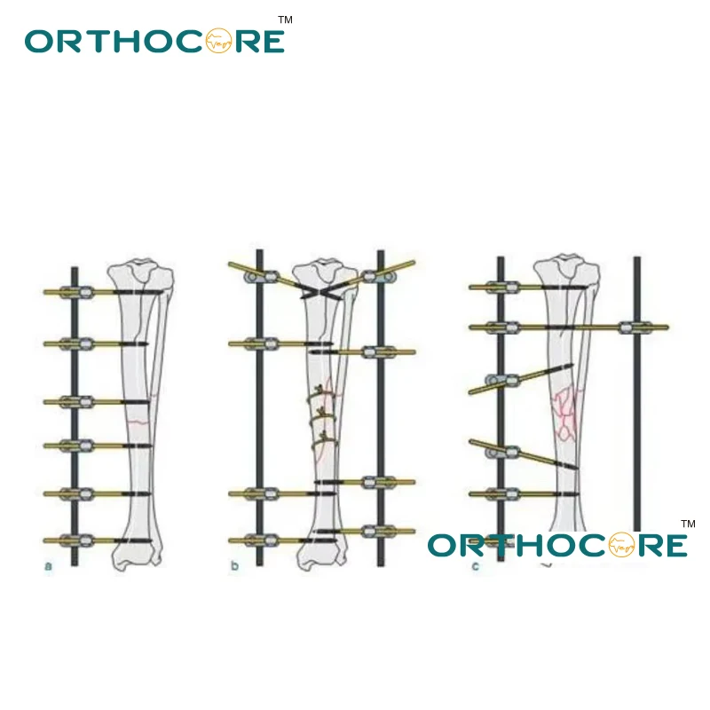 Medium ESF External Fixation SK External Fixation System Veterinary Orthopedic Small Animal Orthopedic