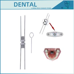 Dental Expansion Screw Orthodontic Palate Expander Frame Type Stainless Steel 8/9/11/13mm Rapid Dentistry Tools Materials Tools