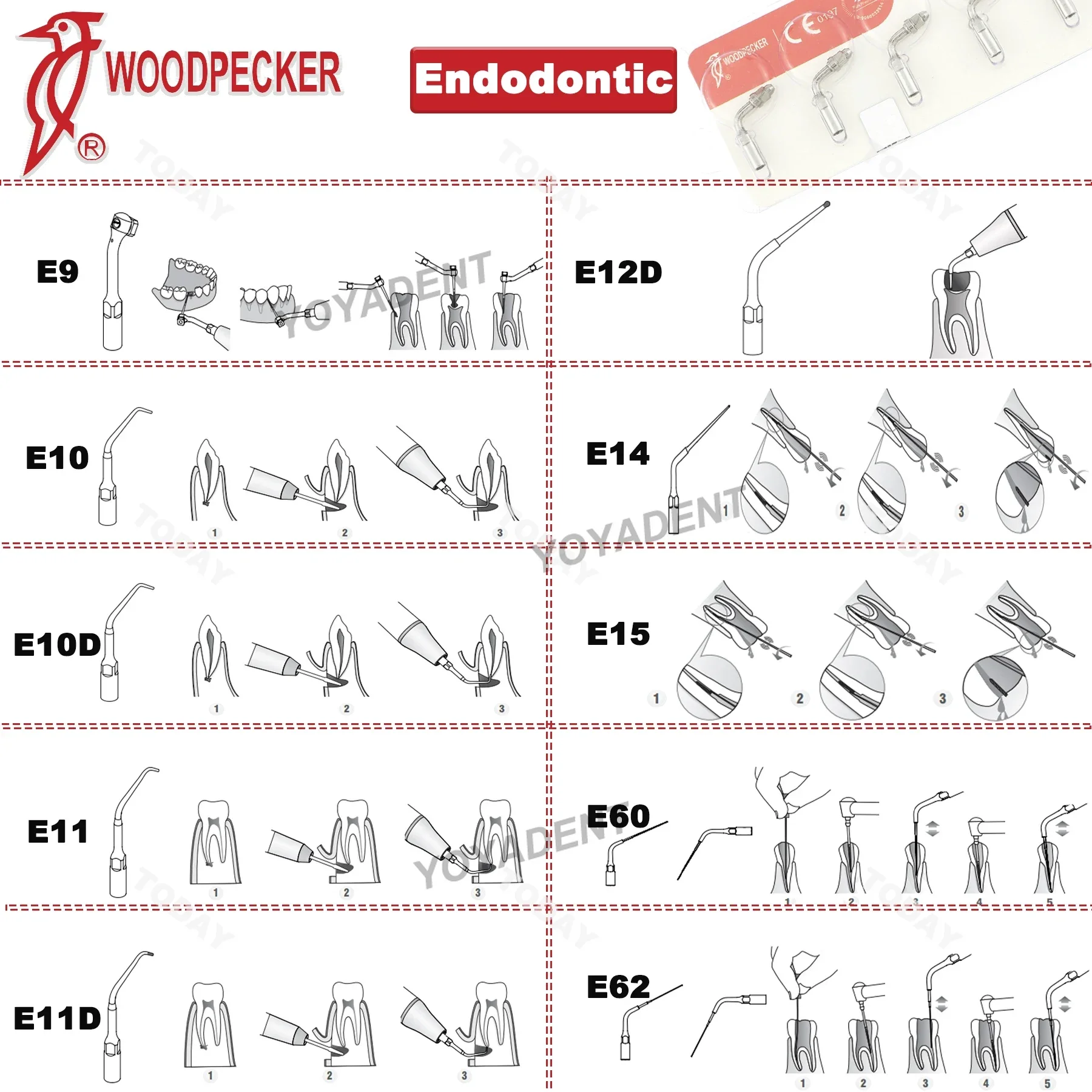Woodpecker Dental Ultrasonic Scaler Tips Scaling Tips Endo/Perio Root Canal Treatment P/E/G Fit EMS UDS Dentist Tools