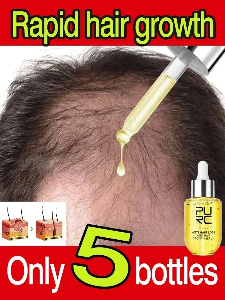 

Fast Hair Growth Ginger Grow Hair Oil Care Anti Hair Loss Scalp Treatment Serum Products Beauty Health For Men Women