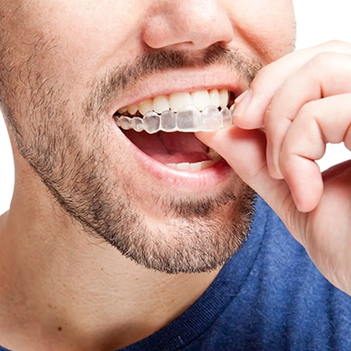 

Invisalign термоформовочная стоматологическая гигиена полости рта, сжимание, шлифовка, отбеливающие лотки для зубов, отбеливатель, каппа, инструмент для ухода