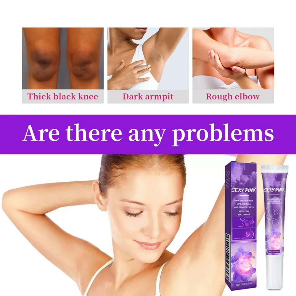 

Отбеливающий крем для удаления меланина, нежный увлажняющий уход за кожей тела для губ, подмышек, коленей, интимных частей