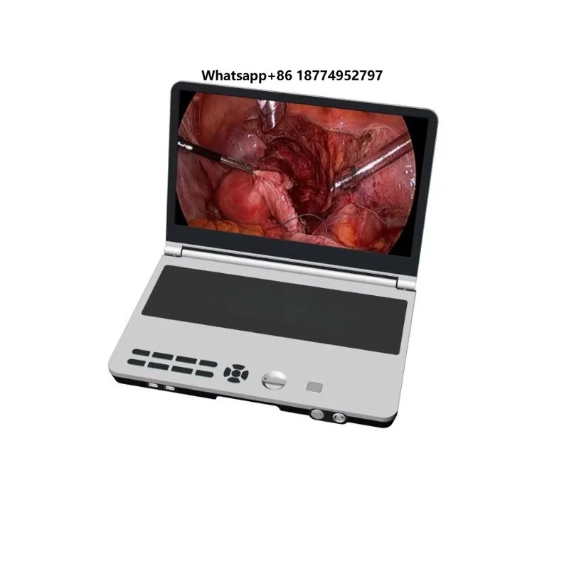 All-in-one endoscopic  system (integrated surveillance  and light source endoscopic )