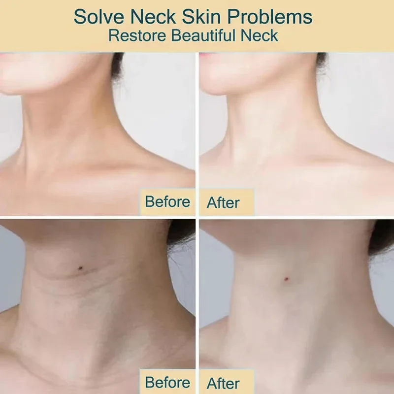 Collagen Neck Mask Eliminate Neck Wrinkle Lines Lifting Whitening Tighten Double Chin Anti-age Rejuvenation Skin Care Product