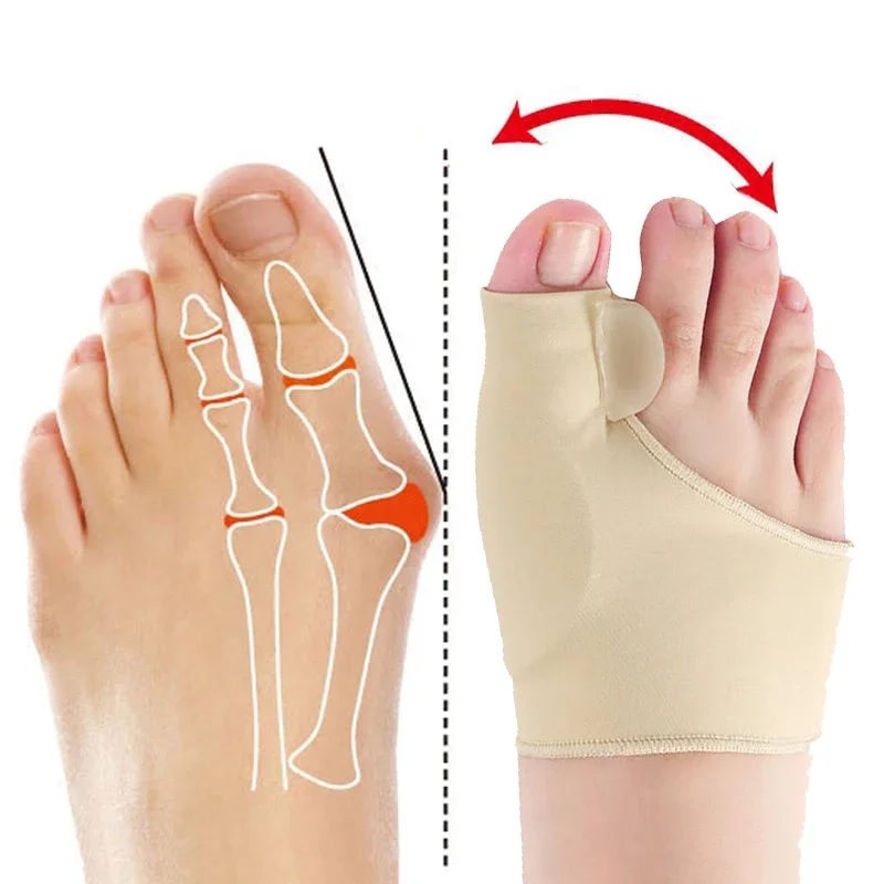

Корректор вальгусной деформации большого пальца ноги, мягкий и дышащий, коррекция пальца ноги, черный, серый цвет кожи. Корректор для предотвращения бурсита бурсита стопы.