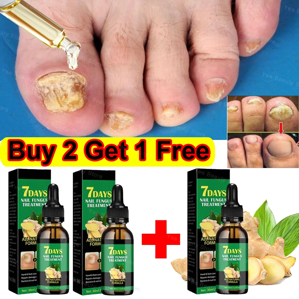 30ml Fungal Nail Treatment Essence Oil Nail Fungus Laser Device Repair Toenail Fingernail Treatment Onychomycosis with Mushrooms