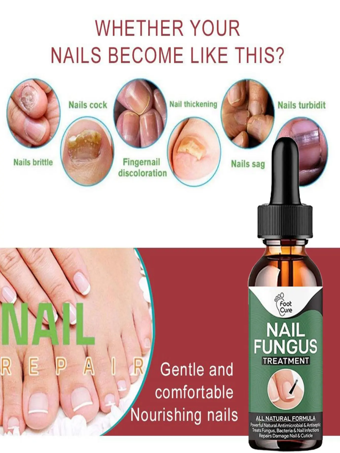 Nail Fungus Treatment Feet Care Essence Nails Foot Repair Toe Nail Fungal Removal Onychomycosis Gel Anti Infection Paronychia