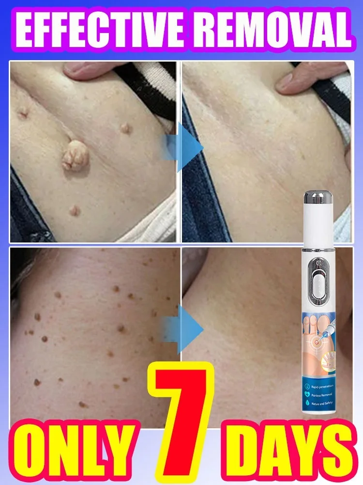 

solve all skin problems