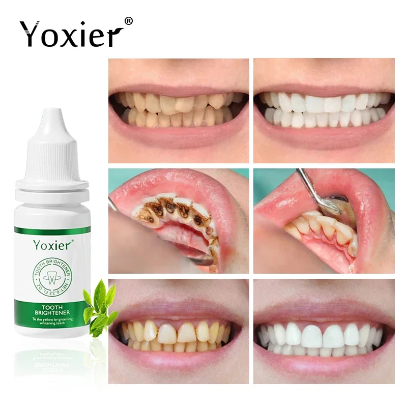 Tooth Brightener Effectively Cleans Teeth Brightens Yellow Teeth Remove Stains Bleaching Tools Fresh Breath Dental Care