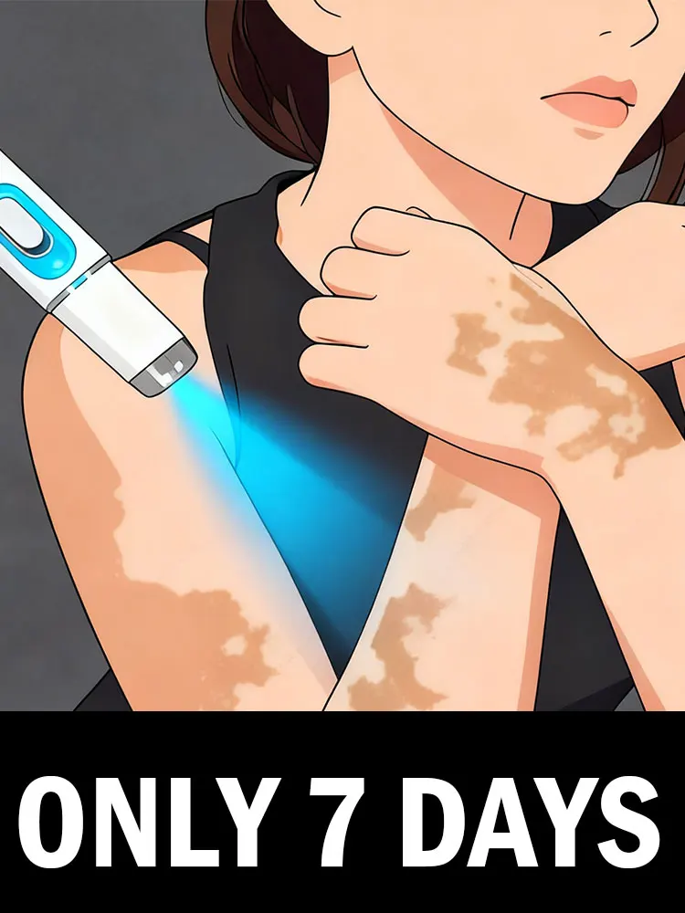 El láser dice adiós al vitíligo