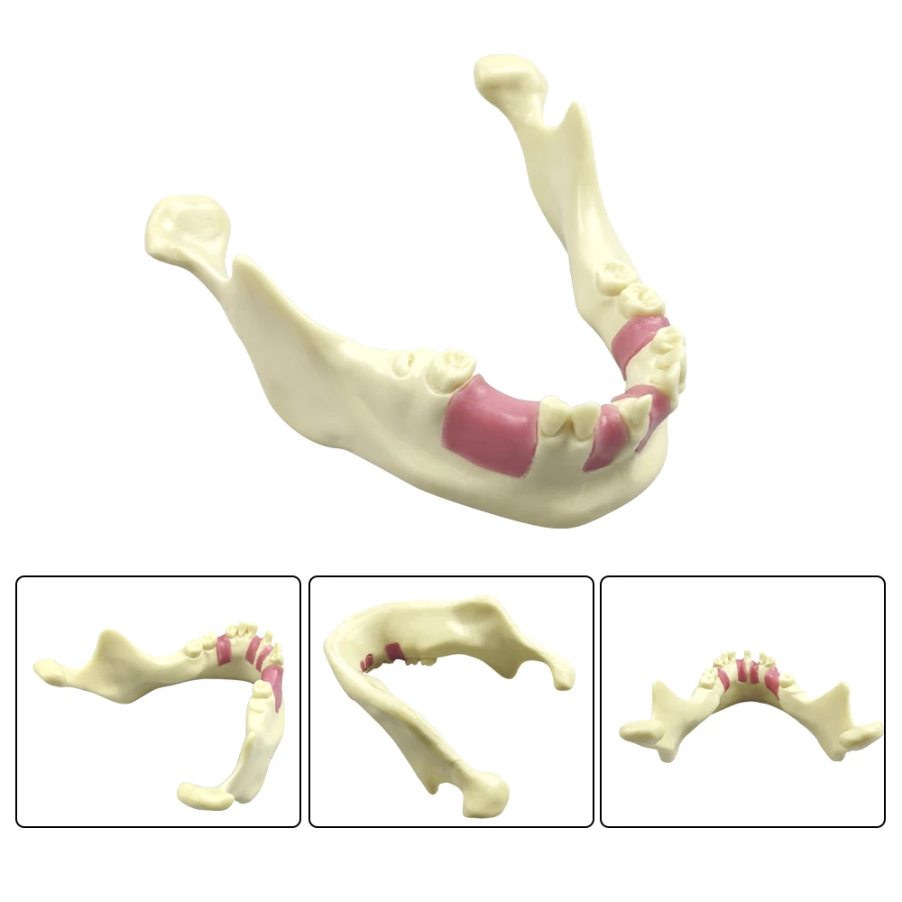 1pcs Dental Mandible Implant Model Jawbone Implant Practice Model Lower Jaw Bone Simulation Training Model For Teaching Studying