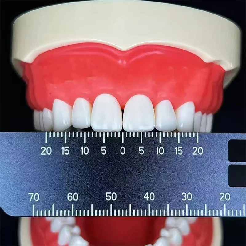 Règle de mesure de précision dentaire AutocNashDental, outils de photographie dentaire, fournisseur dentaire, matériaux de laboratoire, 1 pièce