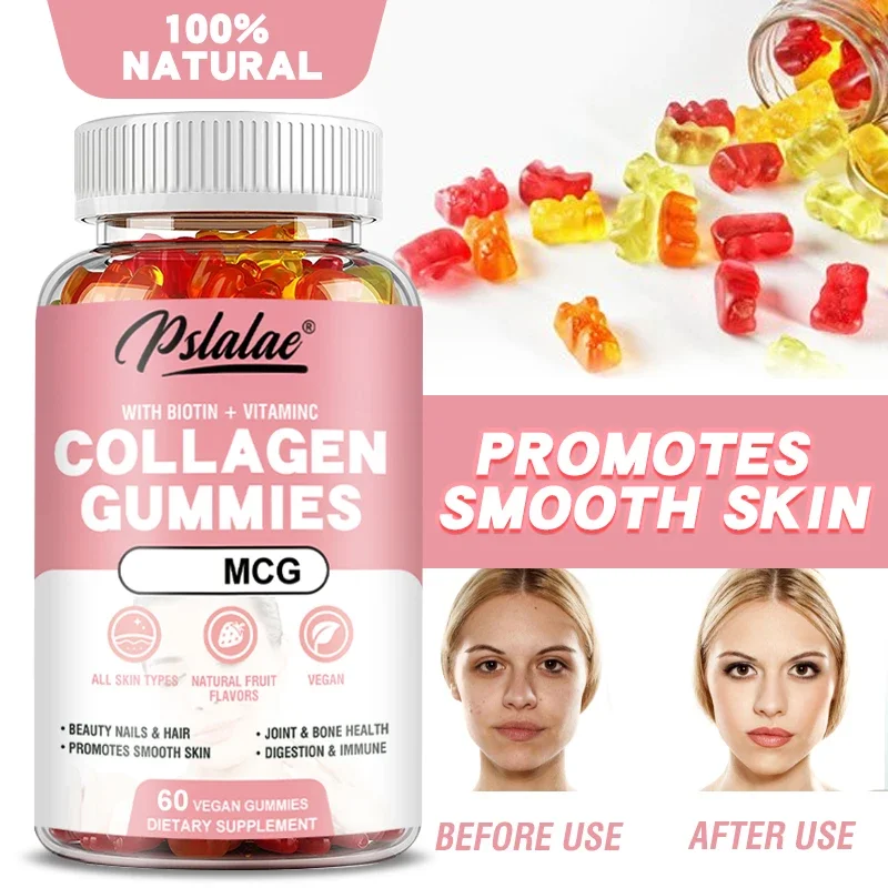 

Коллагеновые жевательные конфеты с витамином С и биотином — поддерживают ногти и волосы, делает гладкую кожу, способствует здоровью суставов и костей.