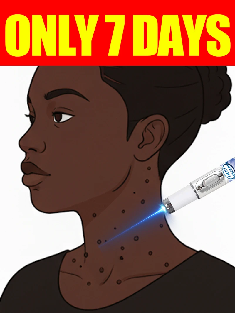 

2025 hot sale, blue light pen solve warts, wart care tools, unisex