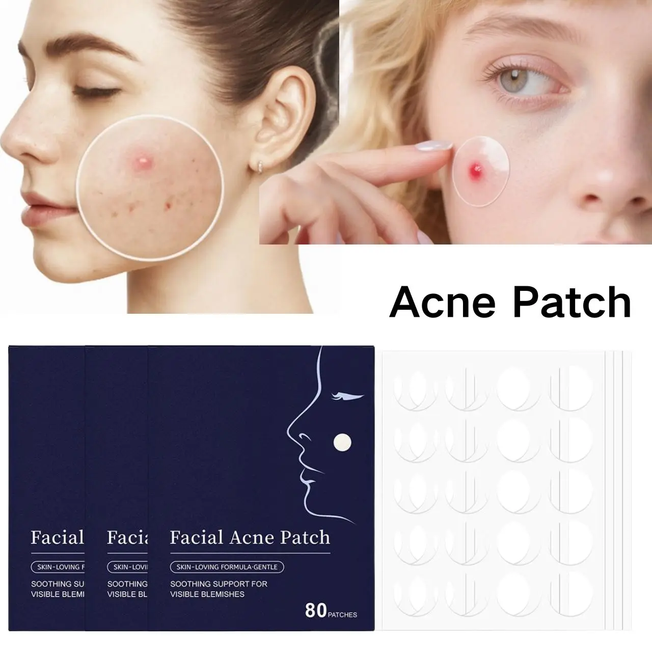 1/3/5Set Fade Acne … - image