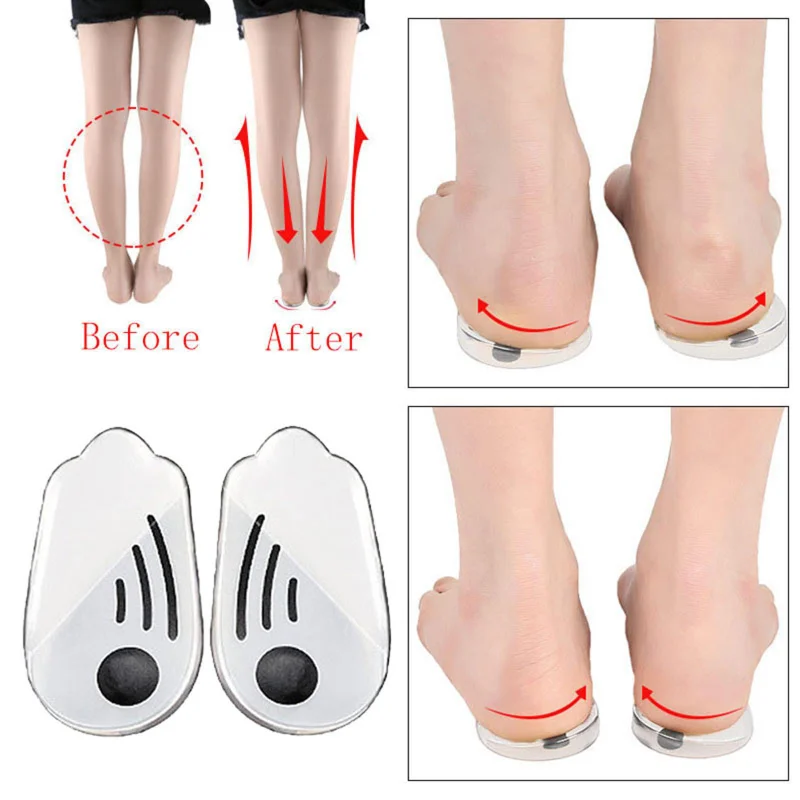 Outdoor Silicone Orthotic Insole O/x Leg Valgus Correction Insole Plantar Fasciitis Gel Insole Magnet Massage Foot Care Products